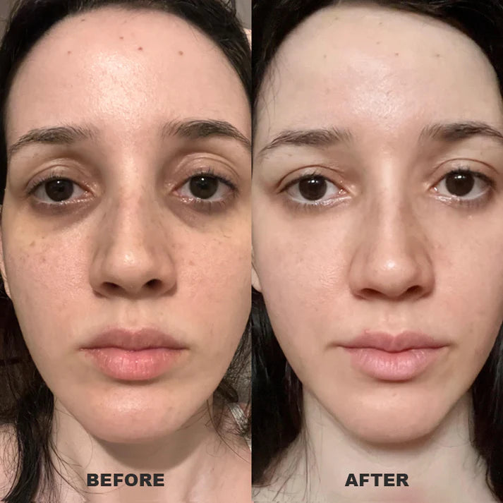 Under Eye Puffiness Remover