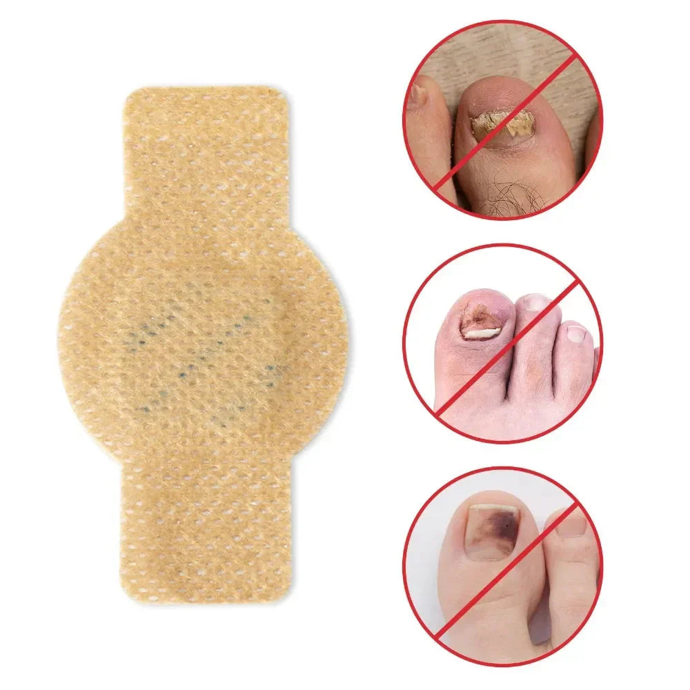 #1 Fungal Nail Patches